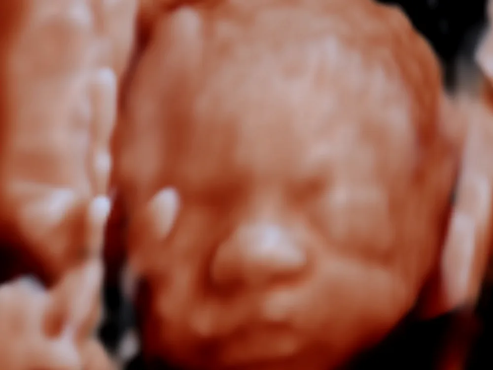Face and hand