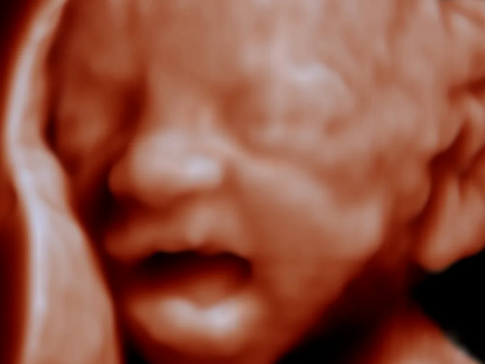 Lips, nose and chin