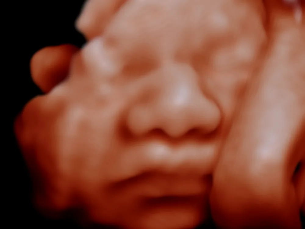 Hand across the face