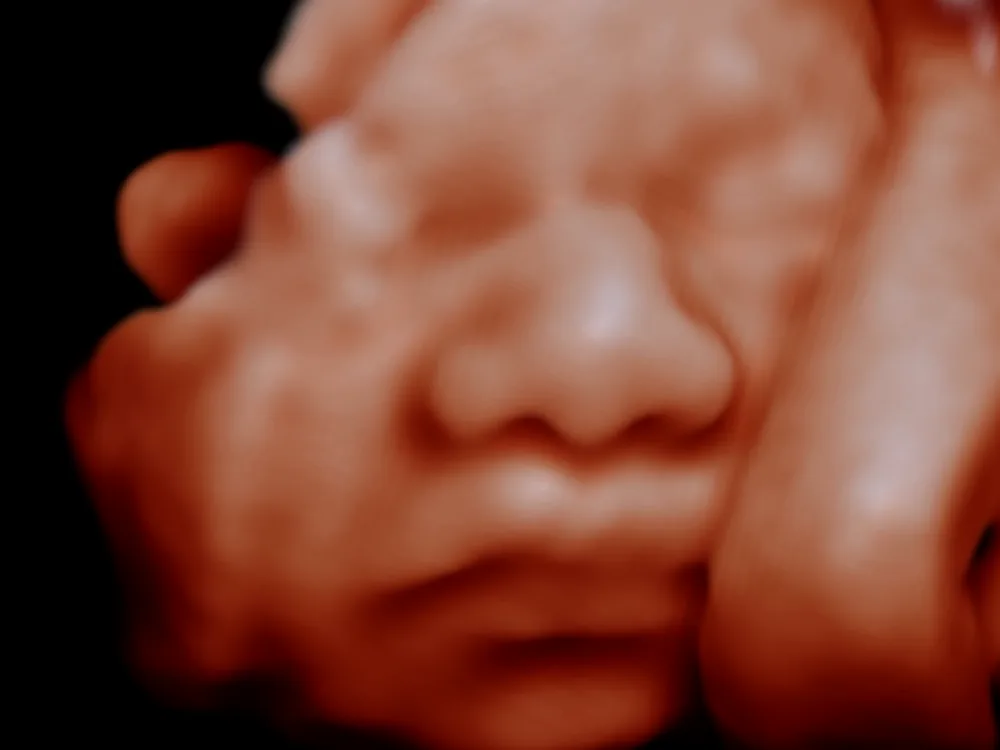 Cheek and hand