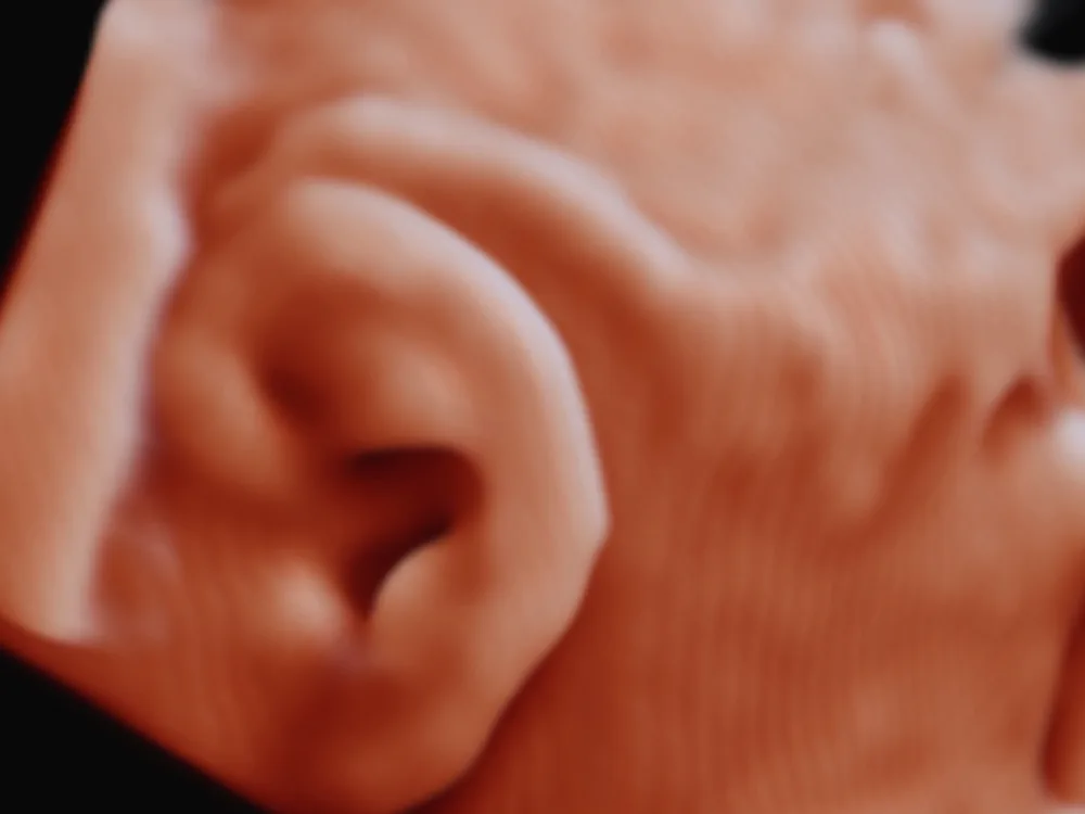 Ear in detail