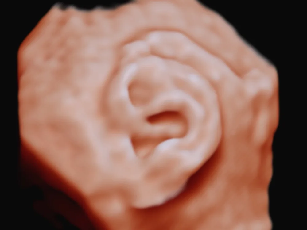 Ear at 35 weeks