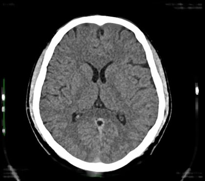 Brain