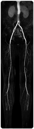 Angiography