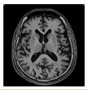 Brain