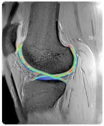 Musculoskeletal