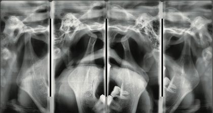 Orthodontic