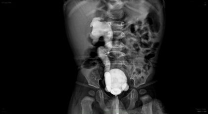 X-Ray procedures