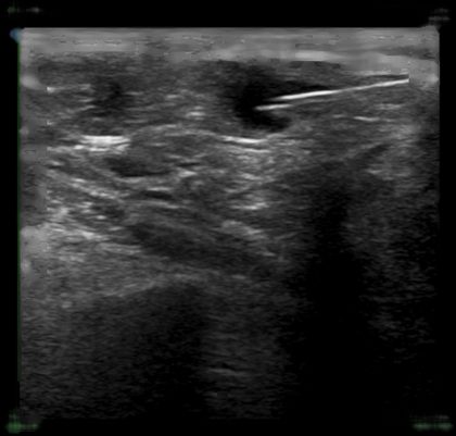 Ultrasonography