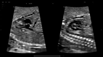 Fetal medicine & women's imaging