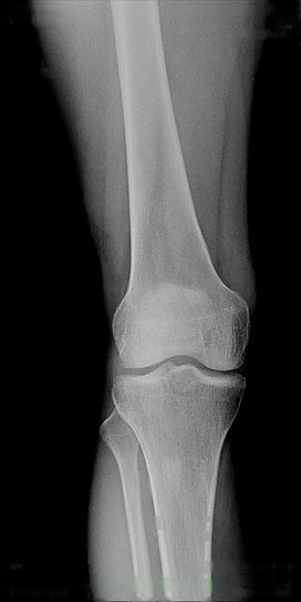 Lower extremities