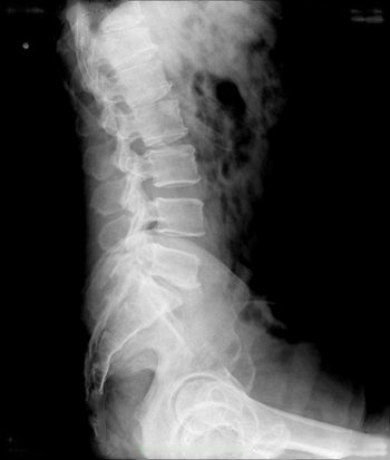Spine & pelvis