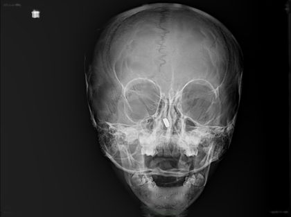 Head & neck