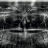OPG & Dental CBCT