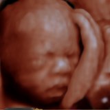 Sonography & Fetal Medicine